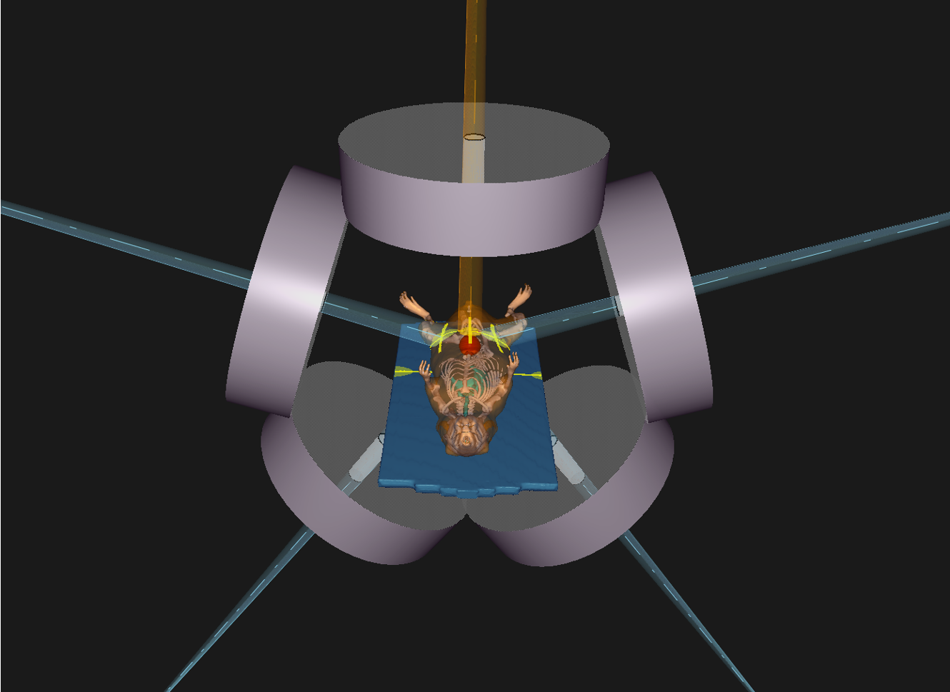 Planning in µ-RayStation.png